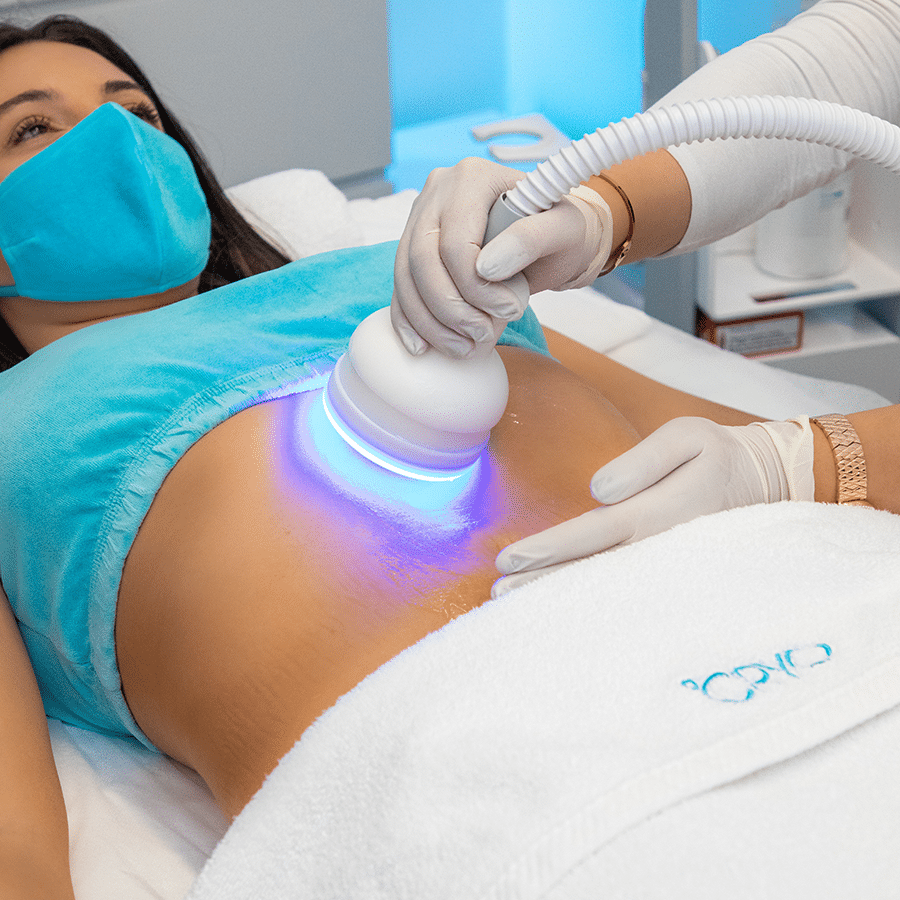 Cryotherapy